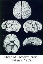 einstein-brain.jpg